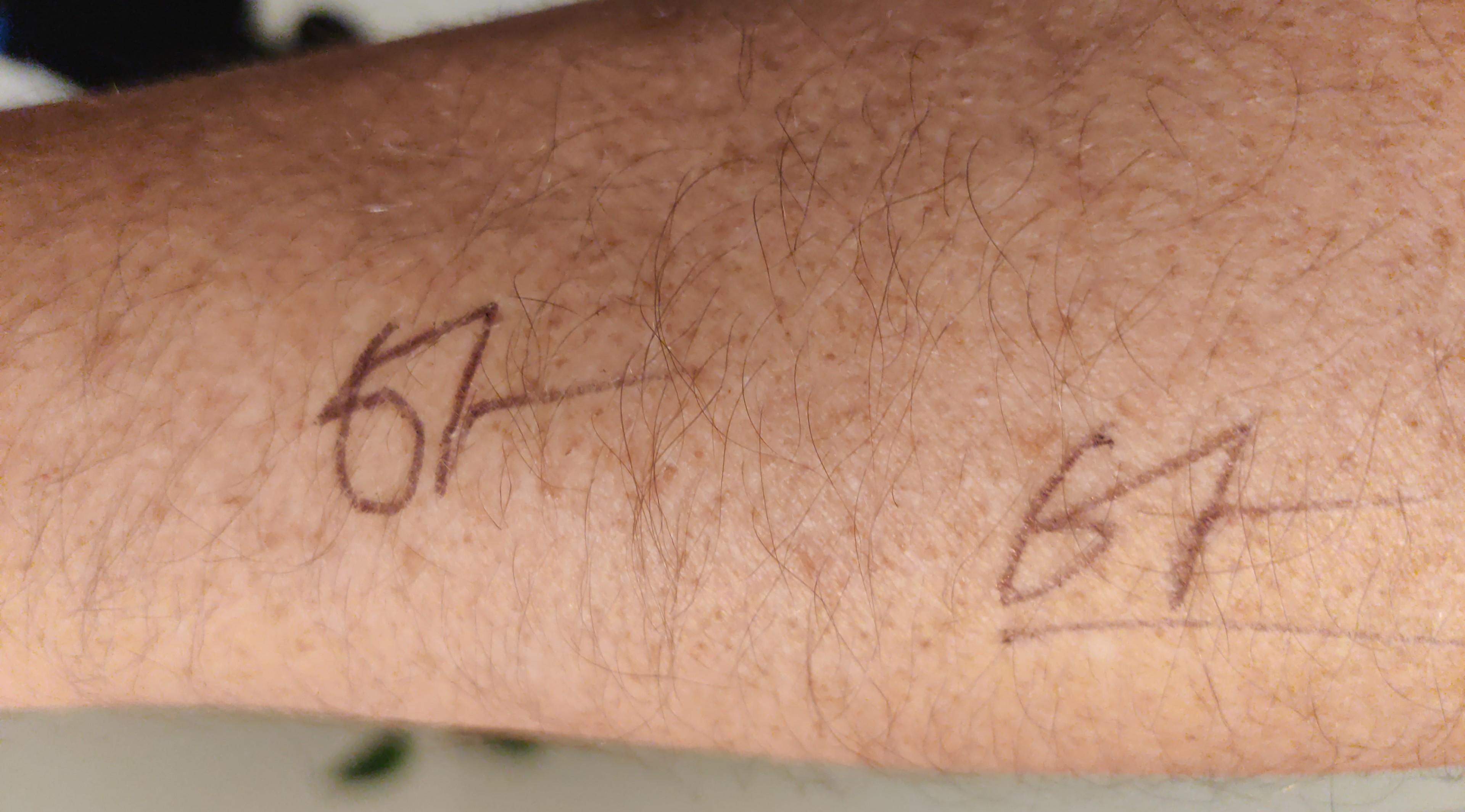An arm so two stylised "67"s written on it with black ballpoint pen.